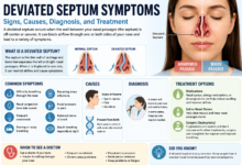 deviated septum symptoms