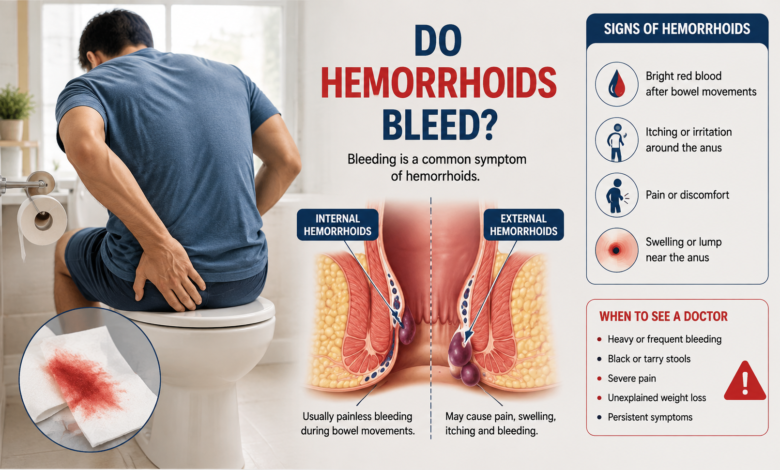 do hemorrhoids bleed