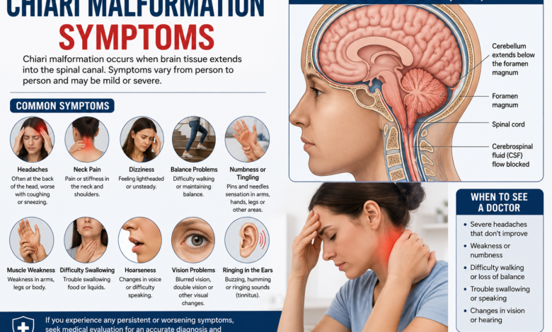 chiari malformation symptoms